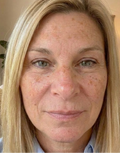 Sabine L., 53