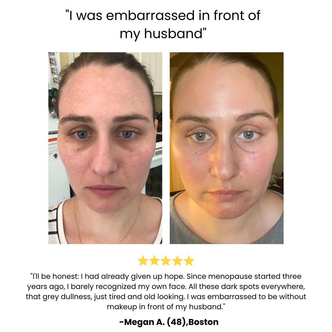 Expert care for hormonally changing skin