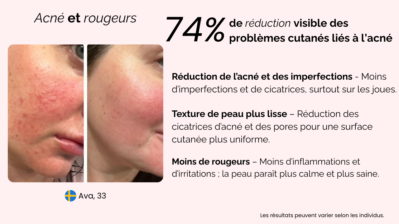 Image de la diapositive