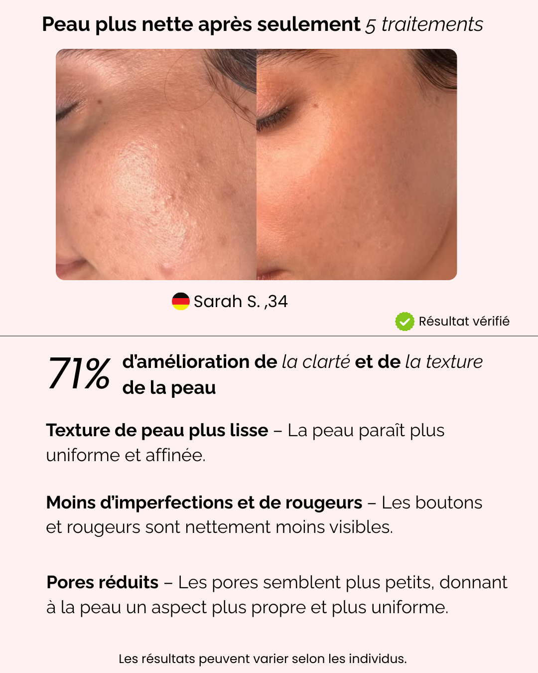 Image de la diapositive