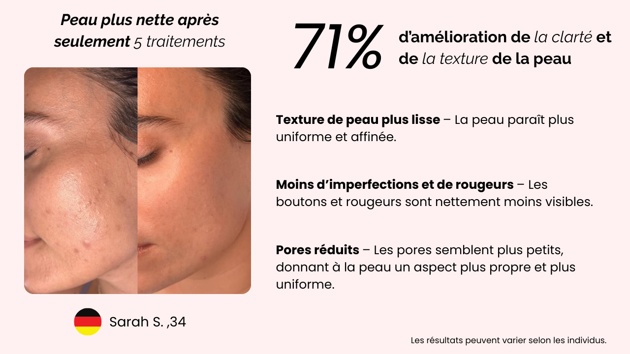 Image de la diapositive