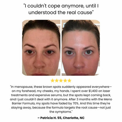 Expert care for hormonally changing skin